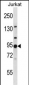 AP1G2 Antibody (N-term)